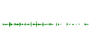 Chewing Food With Mouth Open Faster Speed Sound Effect