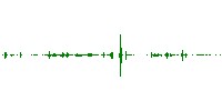 Chewing Food With Mouth Open Sound Effect